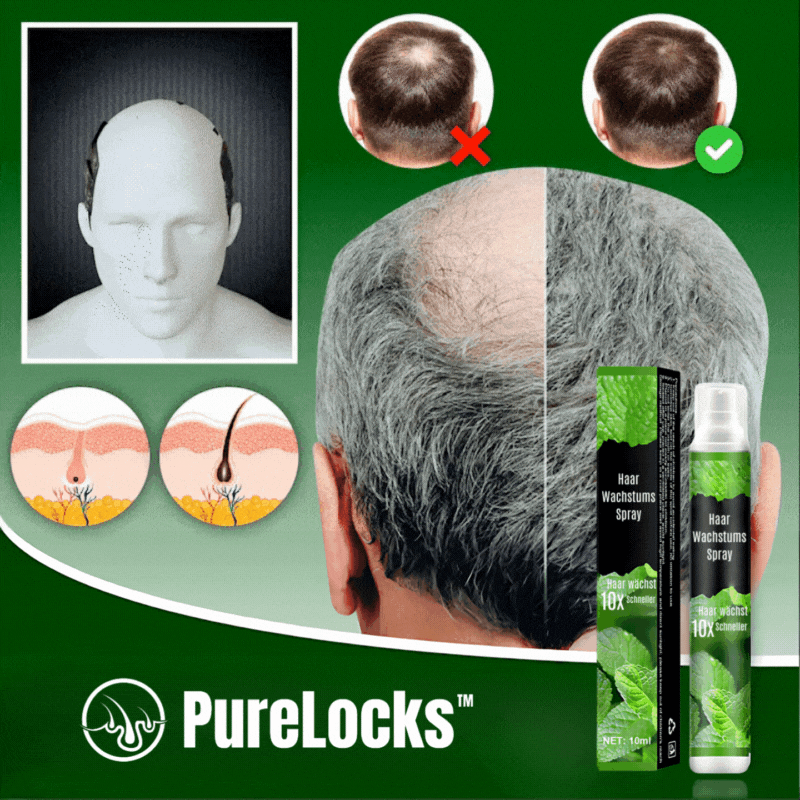 PureLocks™ - Haarwachstumsspray | Verbessert die Gesundheit der Kopfhaut um 50% in 4 Wochen